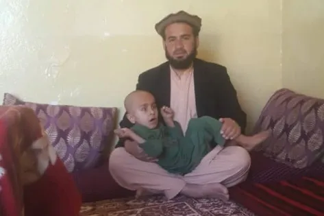 Polio has made the life of a child and his family miserable
