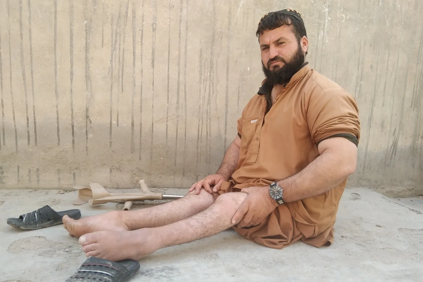 Polio Victim: My Dream for Higher Education Did Not Bear Fruit