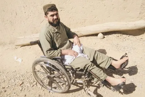 Mohammad Dawood and the Tragedy of His Polio-Induced Disability