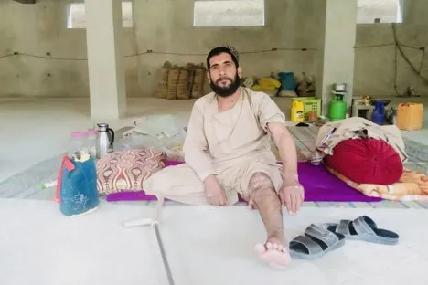 A Disabled Father's Painful Life Due to Polio